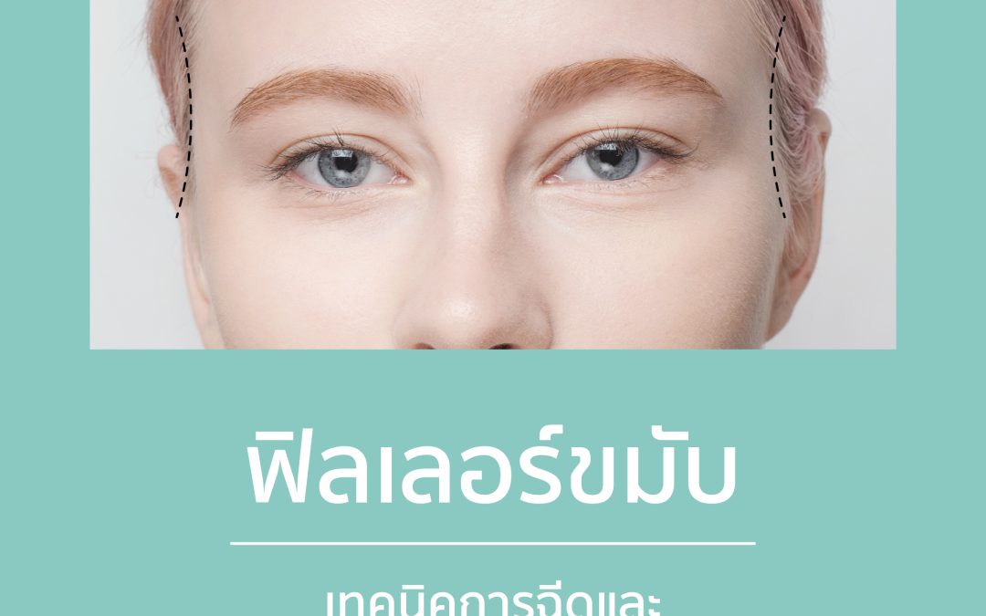 ฟิลเลอร์ขมับ: เทคนิคการฉีดและการเลือกชั้นฉีดเพื่อผลลัพธ์ที่ดีที่สุด